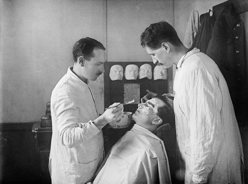 A wounded First World War soldier with facial injuries has a plaster cast made of his face so that a mask can be produced to cover his wounds.The work was undertaken at the 3rd General Hospital in Wandsworth, London.
